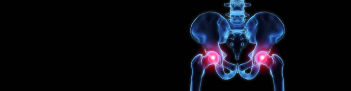 Total Hip Replacement