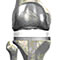 Total Hip Replacement